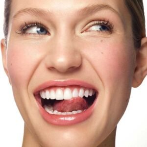 Professional teeth whitening results at Alta Vista Dental in Vista, CA, featuring Dr. Jorge Urrea.