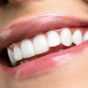 A patient showcasing bright results after receiving professional teeth whitening services in Vista, CA at Alta Vista Dental.